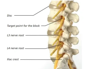 10 Nerve Root Terms To Know Immediately