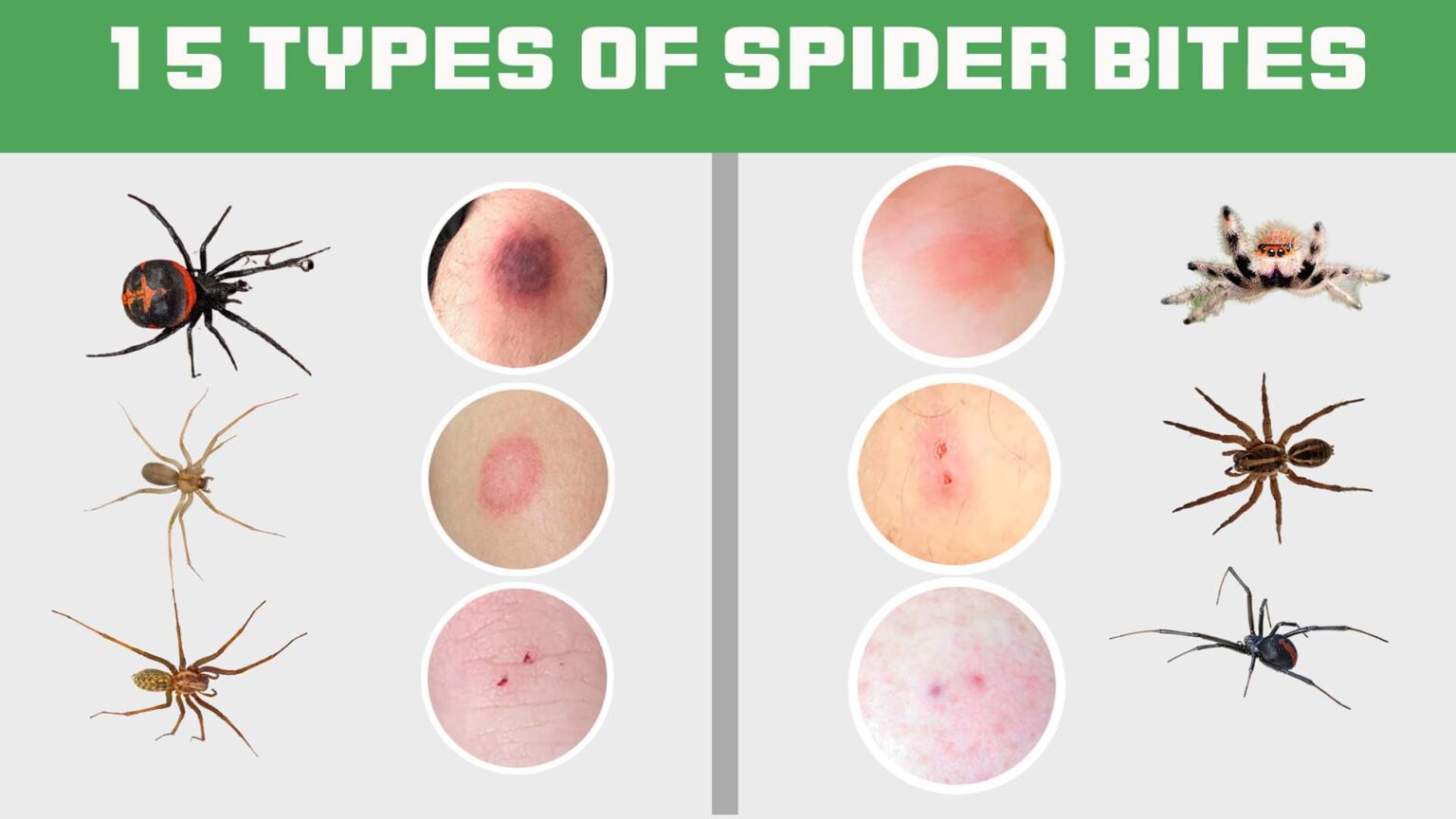 12 Spider Bites Nebraska Facts You Need