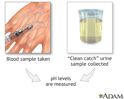 12 Urine Ph Test Tips For Better Health