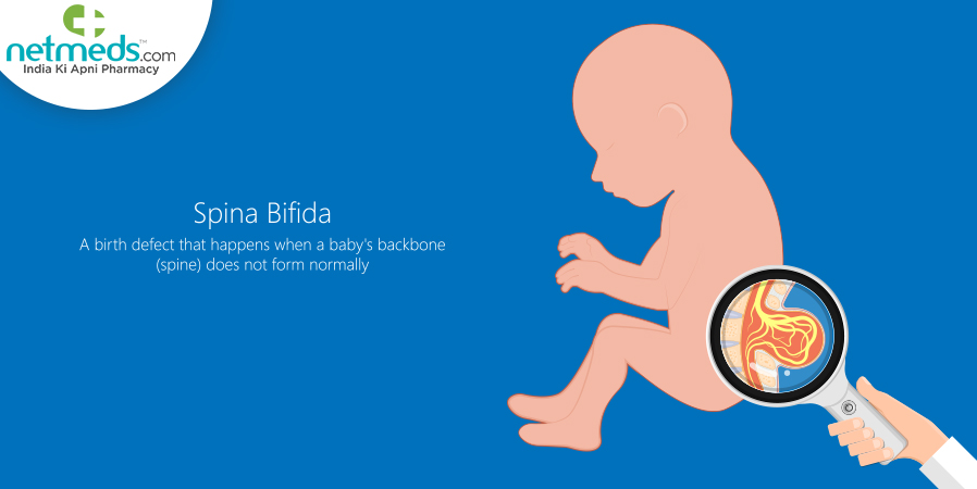 12+ Years Added To Your Life With Spina Bifida Management