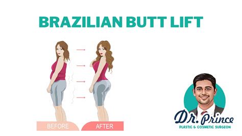Brazilian Butt Lift Sex