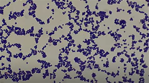Cocci In Pairs Gram Positive