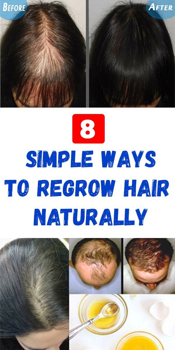 Dr Zorba Hair: Regrow Your Hair With Proven Methods