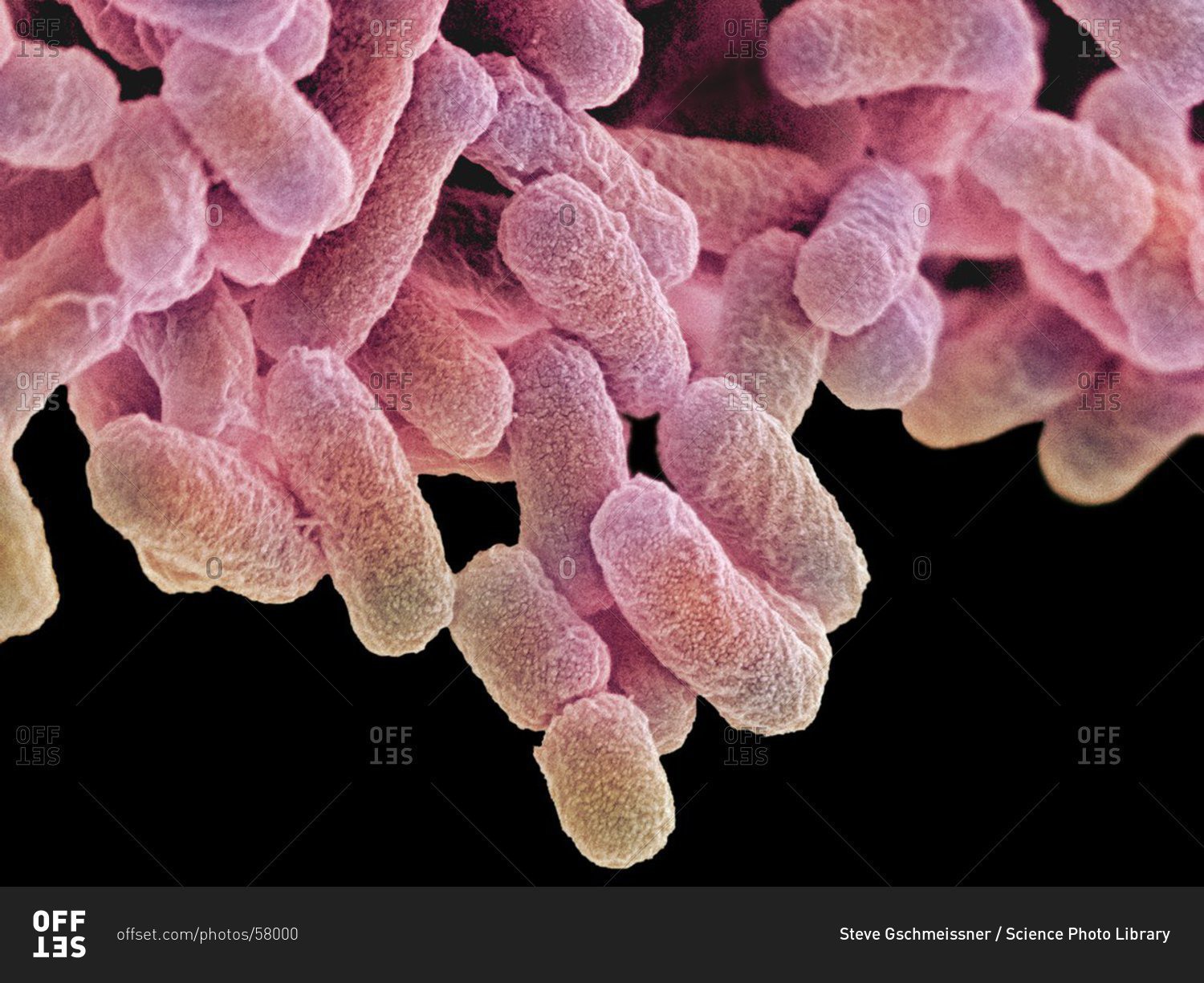 E Coli Microscope: Learn To Detect Quickly