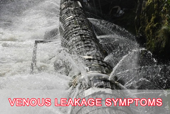 Gas Leakage Symptoms: Know The Warning Signs