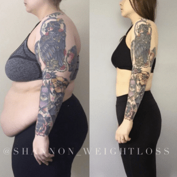 How Do Weight Loss Tattoos Work? Tracking Progress Easily