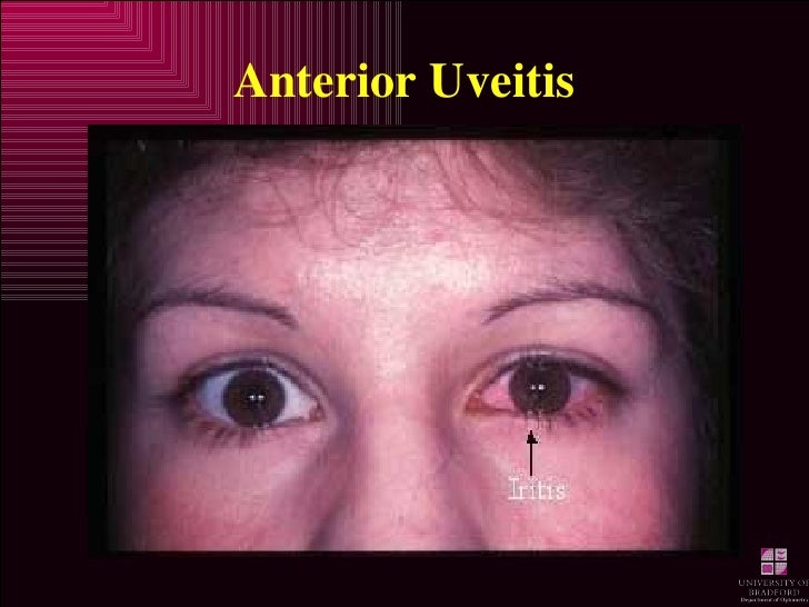 How To Treat Dog Anterior Uveitis? Relief & Recovery Tips