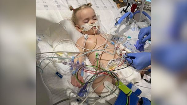 Mom Warns Parents Of The Danger Of Batteries After The Death Of 18 Month Old Daughter Mom Warns Parents Of The Danger Of Batteries After The Death Of 18 Month Old Daughter
