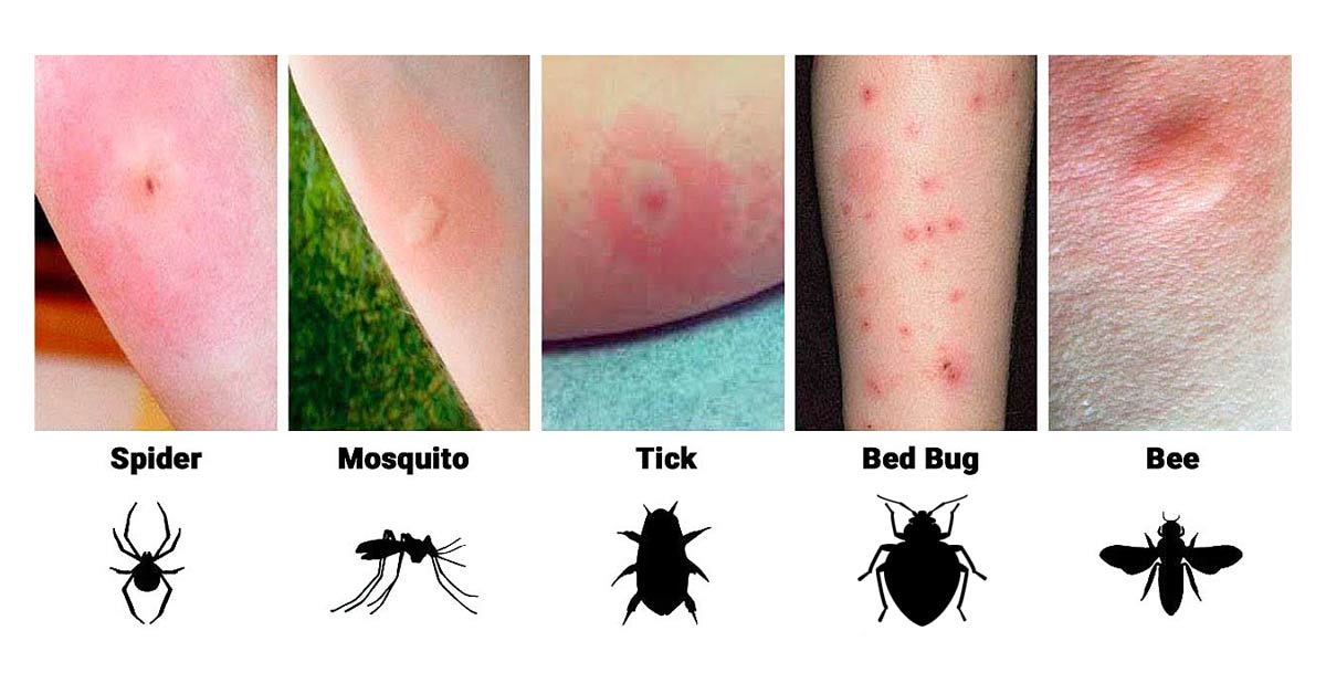 Spider White Dots: Identify & Treat Skin Issues