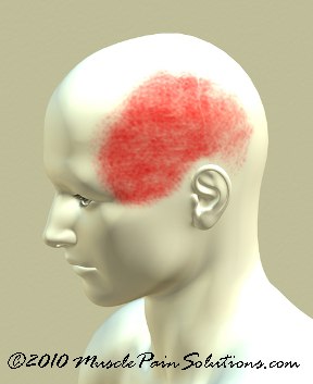 Temple Headache One Side