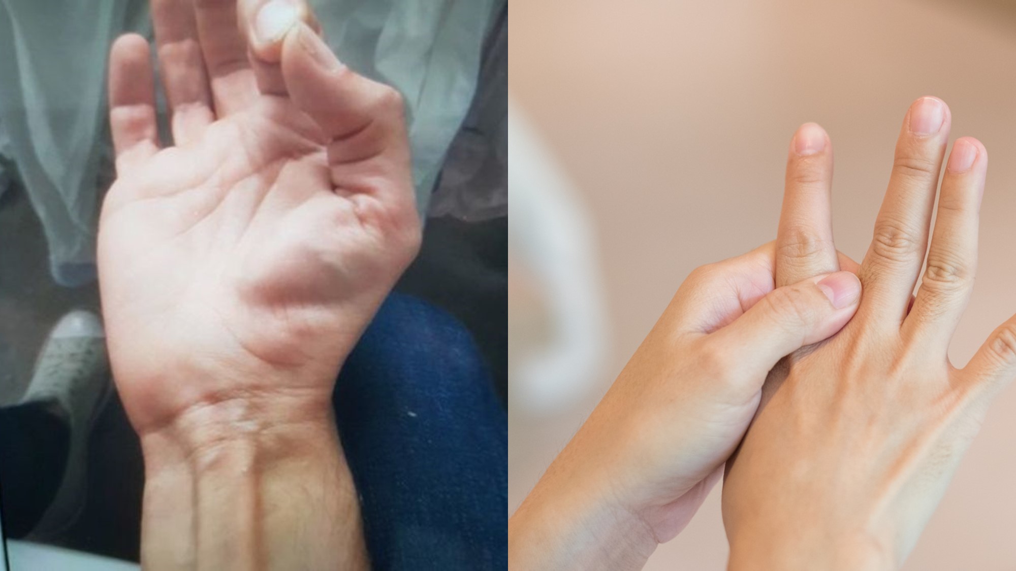Twitching Thumb: Stop Uncontrollable Movements