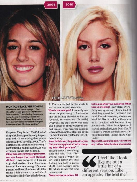 What Are Heidi Montag's Naked Pics? Learn The Truth What Are Heidi Montag's Naked Pics? Learn The Truth