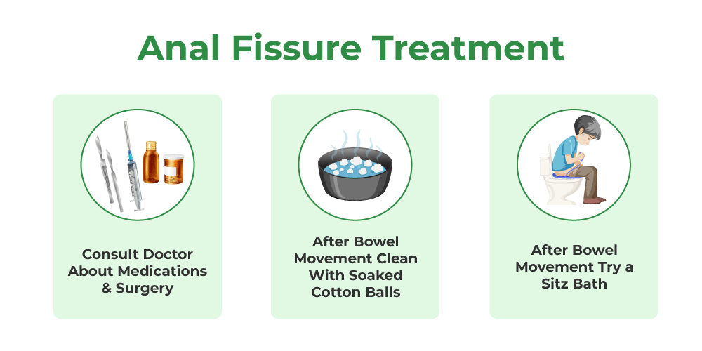 What Causes Fisting Anal Prolapse? Prevention Tips